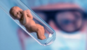 Εξωσωματική Γονιμοποίηση: Οδηγός για υποψήφιους γονείς