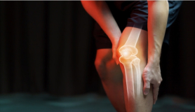 Αθλητισμός και δραστηριότητες που μπορείτε να κάνετε μετά από αρθροπλαστική γόνατος