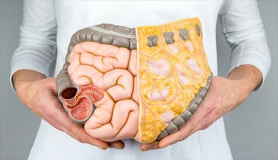 Χολολιθίαση: Κινδυνεύουν περισσότερο οι ασθενείς με νόσο του Crohn;